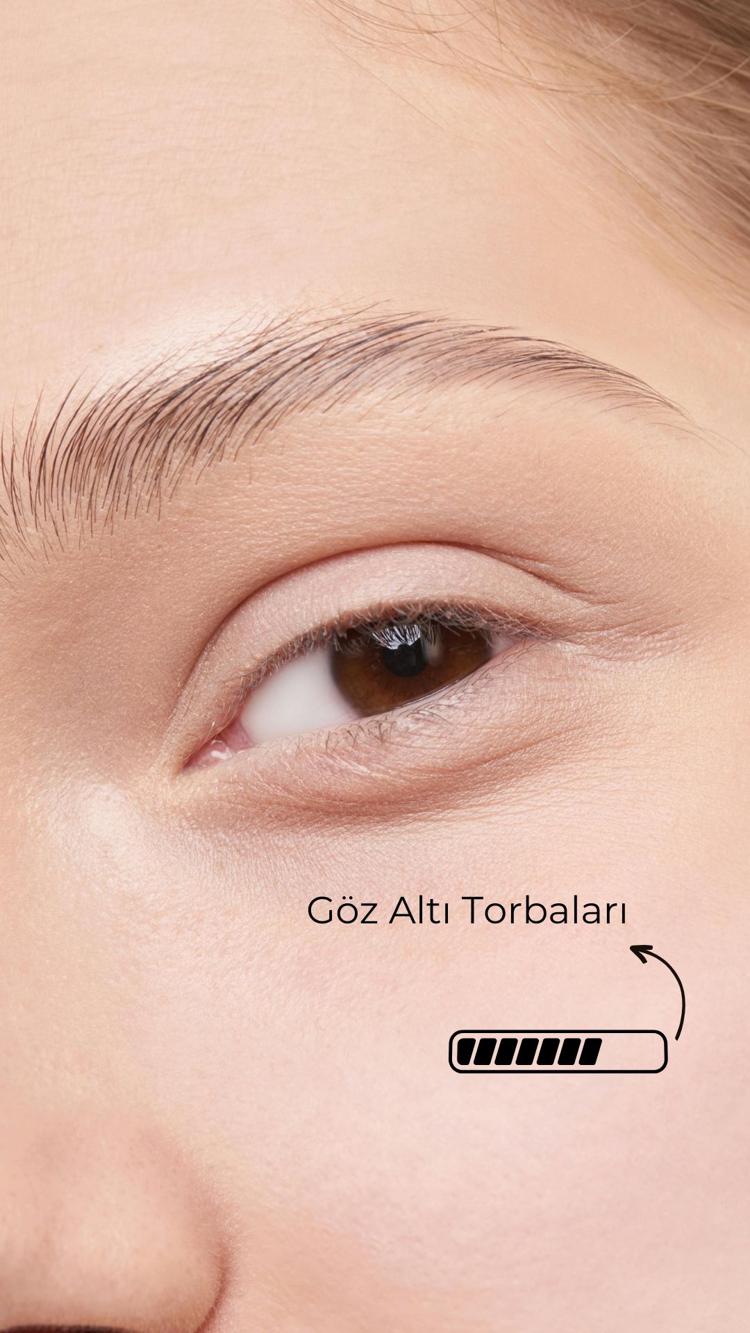 CİLT ÖZELLİĞİNİ ANALİZ EDER - Feature 3